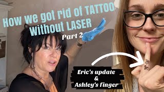 PT 2  IT’s WORKING REMOVE TATTOOS NO LASER  BEFORE AND AFTER  Salt Saline Lime DIY at home [upl. by Nigem]