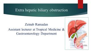 Extrahepatic biliary obstruction Algorithm  Dr Zeinab Ramadan [upl. by Claiborn]