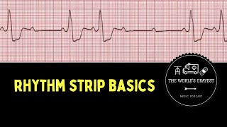 Rhythm Strip Basics Explicit [upl. by Azilem]