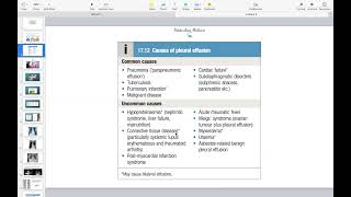 Pericardial Effusion versus Pleural Effusion [upl. by Adnirem263]