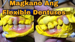 Magkano Ang Flexible Dentures how much flexible dentures in the Philippines [upl. by Llennahc]