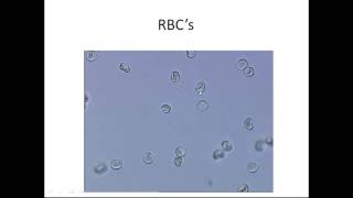 Microscopic Urinalysis [upl. by Dickenson]