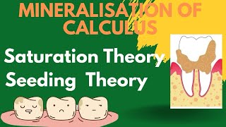 Theories of mineralisation of calculus  Periodontology [upl. by Amero]