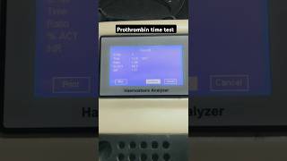 Prothrombin time test  Coagulation test  PT test  INR test  APTT test labtechnician dmlt [upl. by Velma]