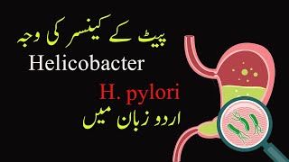 Understanding H Pylori The Stomach CancerCausing Bacteria  Symptoms Treatment amp Prevention [upl. by Eniaral759]