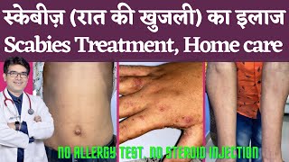 Scabies Treatment Causes Symptoms In Hindi  स्केबीज़ का इलाज कारण लक्षण  रात की खुजली [upl. by Eimot449]