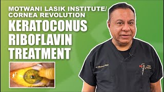 Keratoconus Riboflavin Treatment and Topographic Guided Laser Correction Surgery [upl. by Estel]