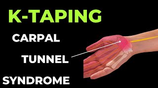 How to treat Carpal Tunnel Syndrome using Kinesiology Tape [upl. by Enimisaj]