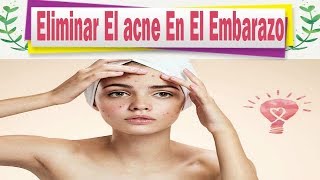 Como Eliminar El Acne En El Embarazo Con Remedios Caseros [upl. by Doomham]