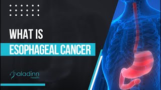 What is Esophageal Cancer  Dr Amit Mathur [upl. by Suolhcin]