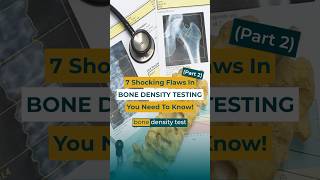 PART 2 Got DEXA Top 7 Problems With BONE DENSITY TESTING [upl. by Zap]