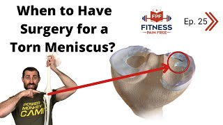 When SHOULD and SHOULDNT Your Patients Have Meniscus Surgery  Meniscectomy Repair  FPF E25 [upl. by Hardwick]