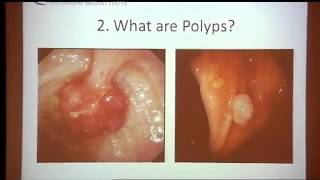 Colorectal Cancer Screening amp Treatment Part 1 of 7 [upl. by Dail]