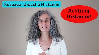 Rosazea  Ursache Histamin MCAS [upl. by Adlihtam]