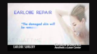 Earlobe Repair Christine Brown MD [upl. by Addia455]