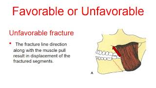 Management of Mandibular Fractures [upl. by Wake]