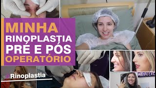 Minha Rinoplastia  Pré e Pós Operatório [upl. by Essiralc]