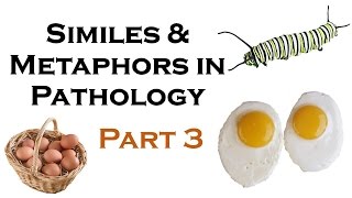 SIMILES AND METAPHORS IN PATHOLOGY PART 3 [upl. by Fang]