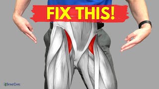 How to Relieve Hip Flexor Pain in 30 SECONDS [upl. by Setiram177]