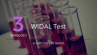 Widal test [upl. by Irrek]