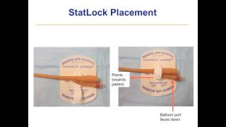 Catheterization Troubleshooting [upl. by Fisoi]