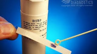 Microbiology oxidase test [upl. by Laerdna]