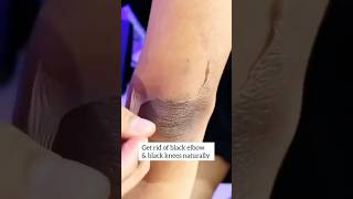 Dark Elbow amp Knees Cleaning Tips😍  Get Rid Of Dark Elbow amp Knees elbows ytshorts [upl. by Werby]