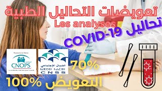 ✅ CNOPS CNSS تعويضات التحاليل الطبية [upl. by Zadoc]