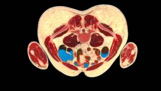 Human Anatomy in Cross Section  Male [upl. by Nerrak]