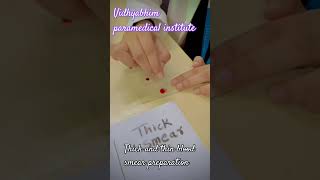 Thick and thin blood smear preparation paramedicaleducation knowledge learningskills success [upl. by Osnofla]