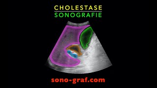 Sonografie  Cholestase [upl. by Akeyla]