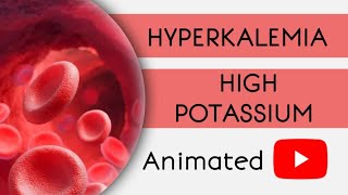 Hyperkalemia in Simple Easy  Animated [upl. by Ahsikit]