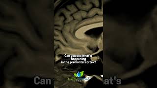 Prefrontal Cortex The Ultimate Brain Upgrade [upl. by Notsecnirp]