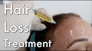 Hair Loss Treatment PRP [upl. by Nolubez344]