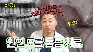 치과의사 생활하면서 처음 본 케이스입니다 대학병원에서도 치료 못한 미스테리한 통증 치료 [upl. by Jules155]