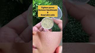 Open pores treatment  Open pores kaise band kare  falgunithestylishbeauty shorts skincare yt [upl. by Leirda]