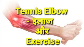 Tennis Elbow Treatment इलाज amp Exercisestretchesphysiotherapy [upl. by Ajram571]