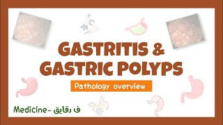 Pathology of the stomach Gastritis amp Gastric polyps  pathology overview GIT surgery عربي [upl. by Nagiam]