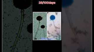 Rhizopus bacteria sudhanshuvlogs shorts minivlog dailyvlog [upl. by Hurty]