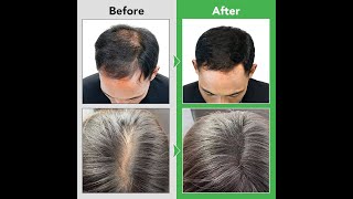 Dok Bua Ku Original Reduce Hair Loss Herbal Shampoo 300ml hairfallsolution dandruff itching [upl. by Baseler998]