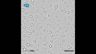 Time lapse of the growth of HepG2 spheroids  CytoSMART Lux2 [upl. by Wagstaff]