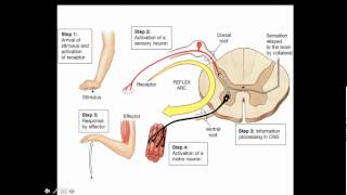 Where is the lesion Part 1 [upl. by Anagrom]