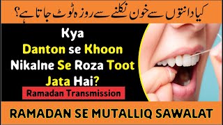 Danton se khoon nikal aye to kia Roza toot jata hai  Imran Madni  Ramazan Transmission [upl. by Drain146]