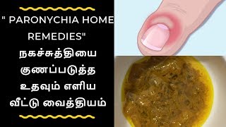 Paronychia Home Remedies  Naga Suthi Patti Vaithiyam Tamil  Naga Suthi Home Remedies In Tamil [upl. by Bascio]