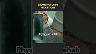 Bronchoscopy procedure shortsviral youtubeshort shortsfeed shortsyoutube youtubevideo youtuber [upl. by Anohs]