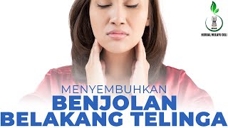 Penyebab Benjolan Belakang Telinga dan Pilihan Pengobatannya  Propolis SM Untuk Benjolan [upl. by Regina]