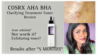 I TRIED THIS TONER FOR 5 MONTHS  MY HONEST REVIEW  IN TAMIL  COSRX AHA BHA TREATMENT TONER [upl. by Anett]