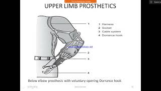 ORTHOSIS amp PROSTHESIS [upl. by Daniell]