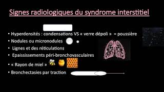 TFR  Différence entre le syndrome alvéolaire et interstitiel à la radiographie [upl. by Lonee]