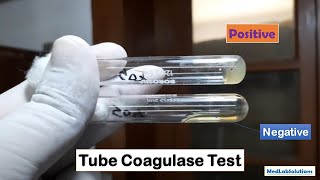 Tube Coagulase Test Positive and Negative Demonstration [upl. by Leuams207]